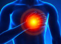 Chest Pain Left Side