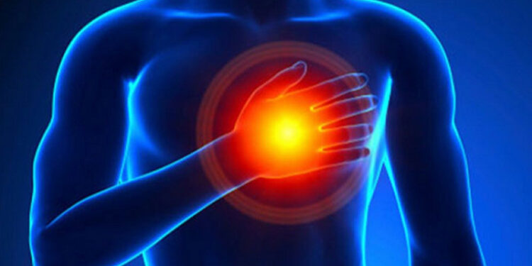 Chest Pain Left Side